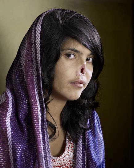 Bibi Aisha, gadis Afganishtan berusia 18 tahun yang telinga dan hidungnya dipotong oleh suaminya, dalam foto yang diambil oleh Jodi Bieber, fotografer Afrika Selatan untuk majalah Time. Foto ini mengundang kontroversi saat dimuat sebagai sampul majalah Time bulan Agustus 2010 karena dikaitkan dengan isu politik, eksploitasi dan sentimen agama. Foto ini menjadi World Press Photo of the Year tahun 2010. Bibi dibawa ke Amerika Serikat oleh Yayasan Grossman Burn dan menjalani penanganan kosmetik gaya Hollywood di Los Angeles. Kini Bibi telah berubah menjadi gadis ‘normal’ yang cantik. Namun lebih baik dari itu, ia terbebas dari kekejaman suaminya dan bisa menentukan nasibnya sendiri. Bibi kini tinggal di New York. Foto ini adalah milik Jodi Bieber, Institute for Artist Management, diambil untuk majalah Time. Foto diambil dari laman National Geographic di sini.